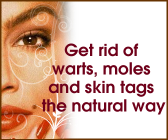 rid warts